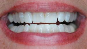 classic-patient-after