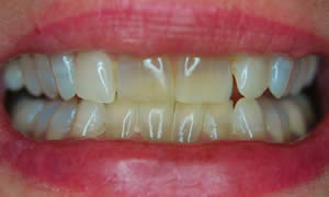 classic-patient-before